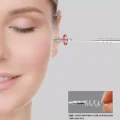 ឈុតសម្អាតត្រចៀក - 6PCS Ear Cleaner Wax Remover - Image 5